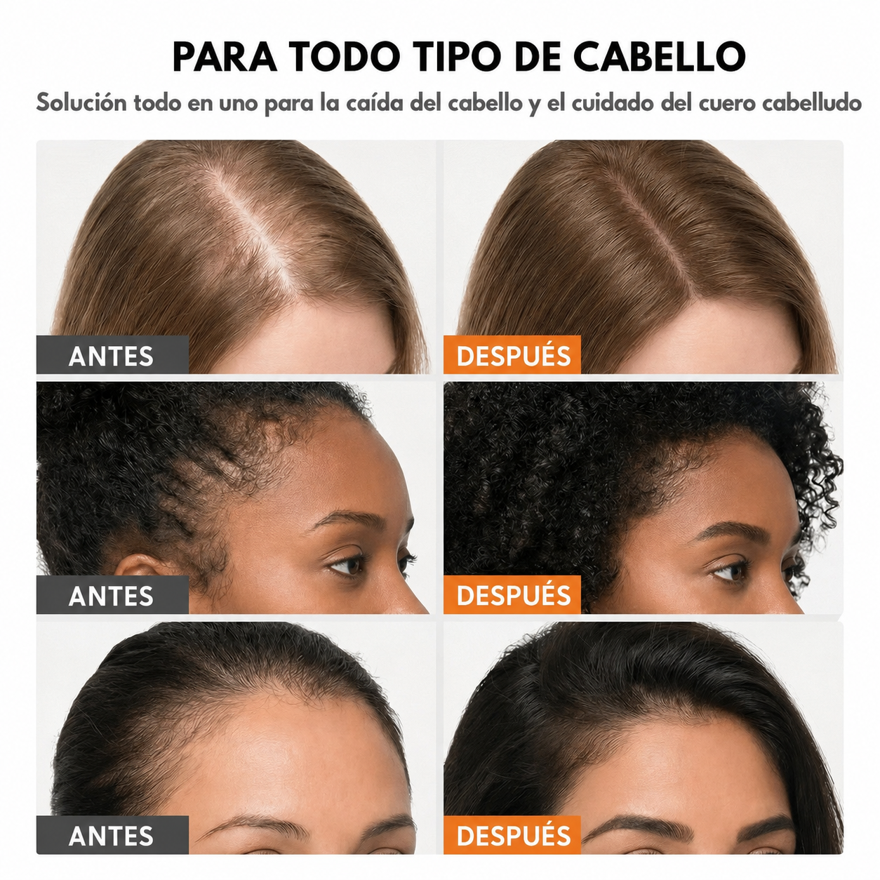 Sérum para el crecimiento del cabello #1 en corea