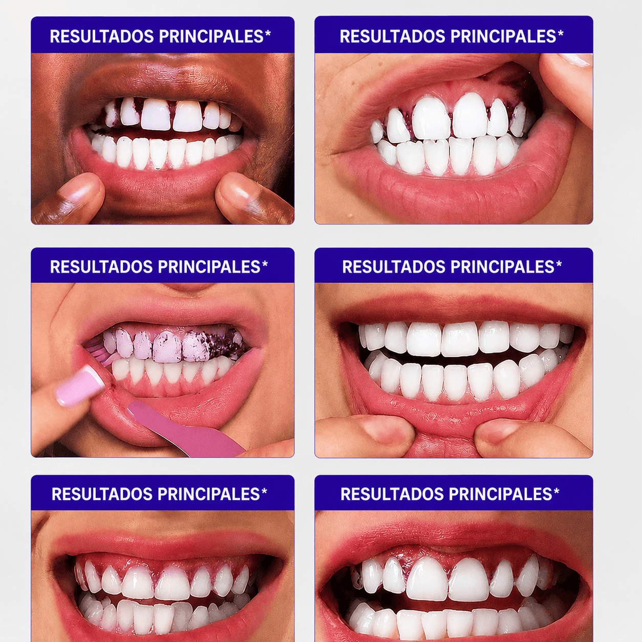 Tiras blanqueadoras moradas Venett™
