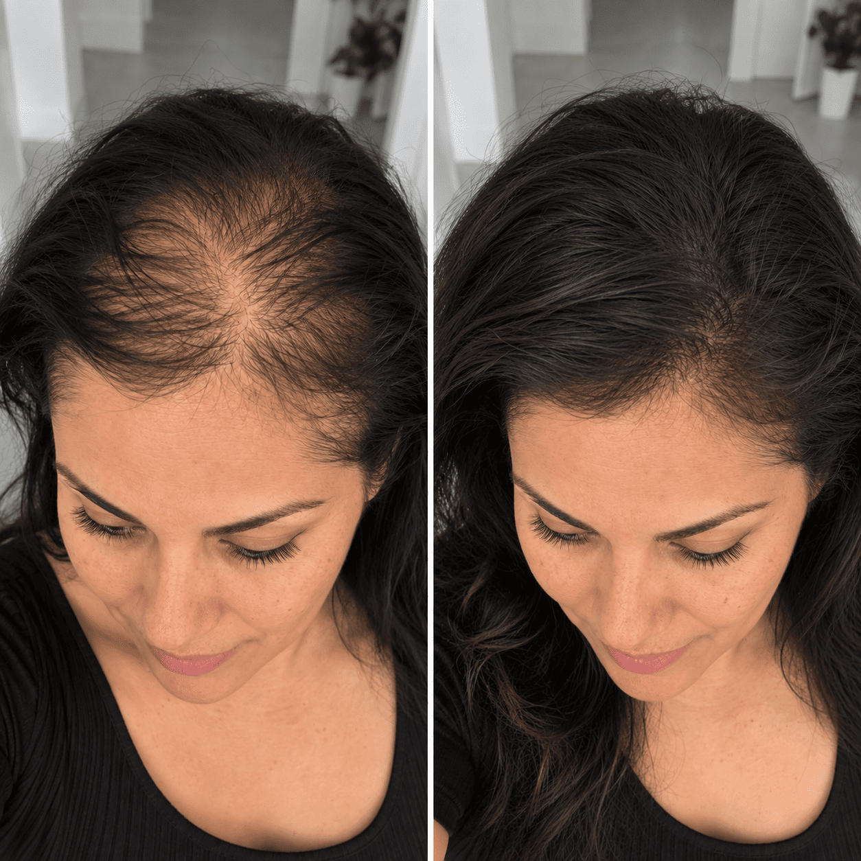Anticaída+crecimiento del cabello-Venett