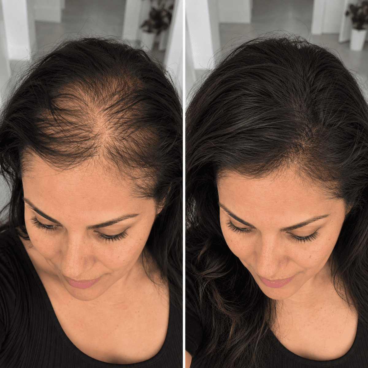 Anticaída+crecimiento del cabello-Venett