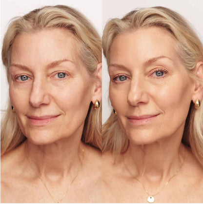 Base Anti-Edad 4-en-1 Venett