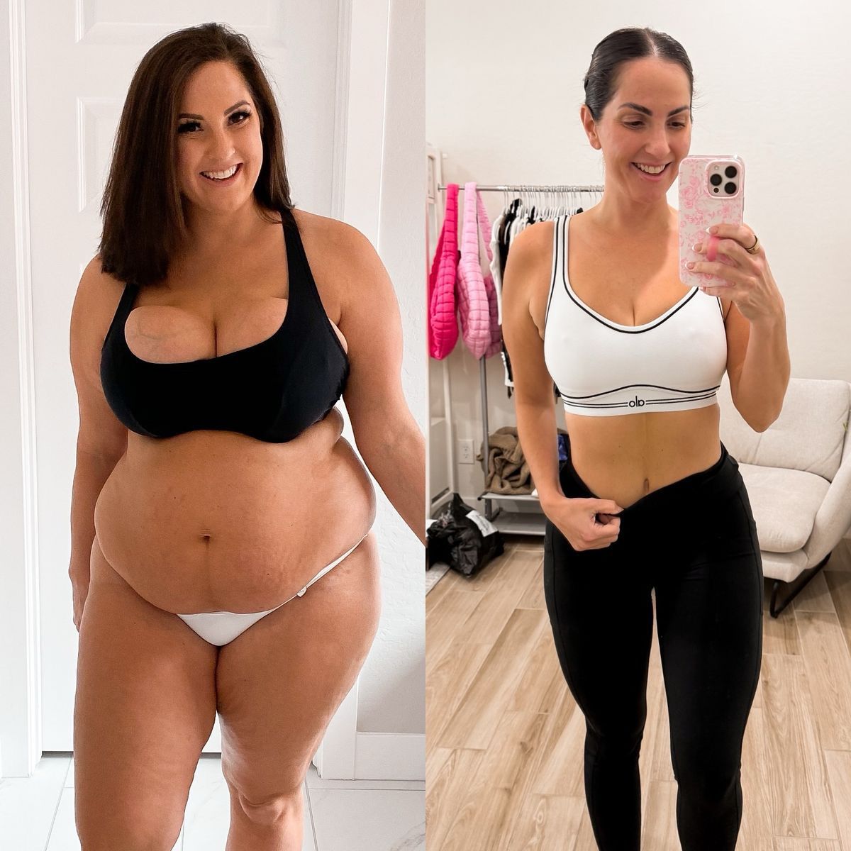 Parches GLP-1 Venett